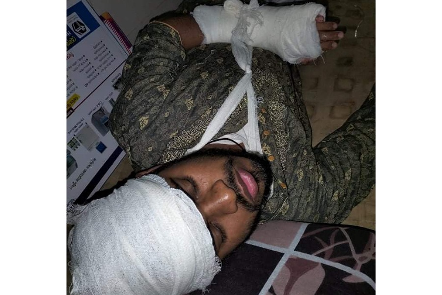 টনকী ইউনিয়নে নৌকা প্রতীক না পেয়ে প্রতিপক্ষের উপর হামলা