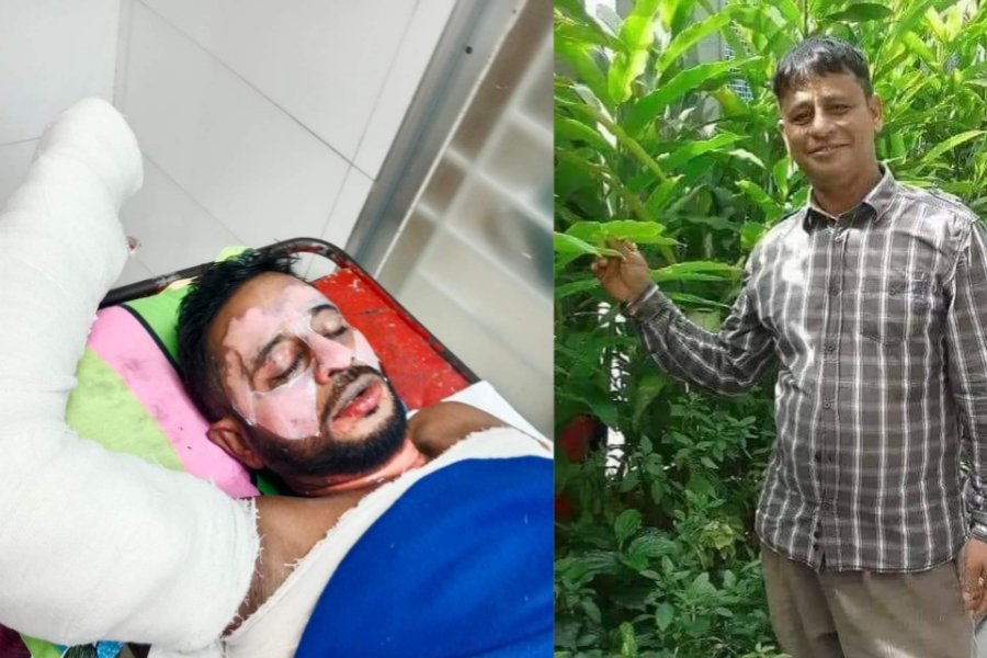 বুড়িচংয়ে রাইস মিলের ছাইয়ের আগুনে দগ্ধ কৃষকের মৃত্যু