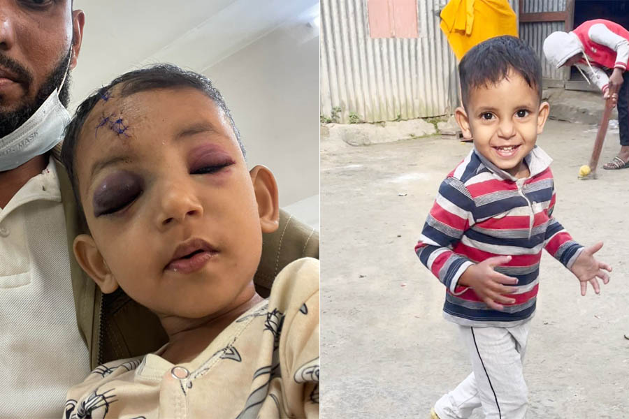 মুরাদনগরে  পিতাকে না পেয়ে দেয় বছরের শিশুকে কুপিয়ে জখম